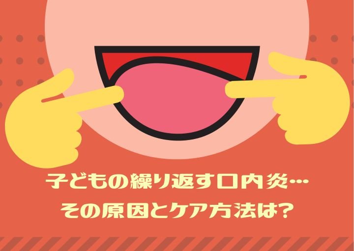 子どもの繰り返す口内炎・・その原因とケア方法は？